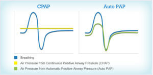 Auto CPAP vs. Straight CPAP - CanSleep Services Inc